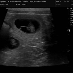 2013_01_10_Ultraschall