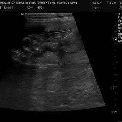 2013_01_24_Ultraschall_a