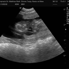 2013_01_24_Ultraschall_b